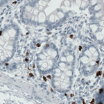 MMP9 Antibody in Immunohistochemistry (Paraffin) (IHC (P))