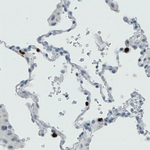 MMP9 Antibody in Immunohistochemistry (Paraffin) (IHC (P))