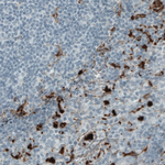 MMP9 Monoclonal Antibody (CL0538)