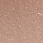 Beta III Tubulin Antibody in Immunohistochemistry (Paraffin) (IHC (P))
