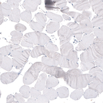 Beta III Tubulin Antibody in Immunohistochemistry (Paraffin) (IHC (P))