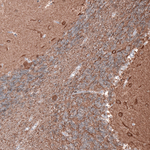 Beta III Tubulin Antibody in Immunohistochemistry (Paraffin) (IHC (P))
