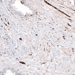 Beta III Tubulin Antibody in Immunohistochemistry (Paraffin) (IHC (P))