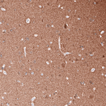 Beta III Tubulin Antibody in Immunohistochemistry (Paraffin) (IHC (P))