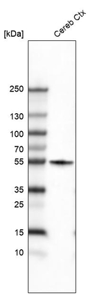 Beta III Tubulin Antibody in Western Blot (WB)