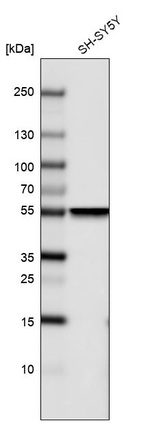 Beta III Tubulin Antibody in Western Blot (WB)
