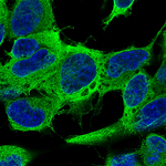 Beta III Tubulin Antibody in Immunocytochemistry (ICC/IF)