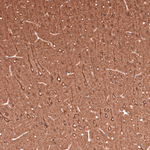 Beta III Tubulin Antibody in Immunohistochemistry (Paraffin) (IHC (P))