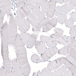 Beta III Tubulin Antibody in Immunohistochemistry (Paraffin) (IHC (P))