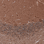 Beta III Tubulin Antibody in Immunohistochemistry (Paraffin) (IHC (P))