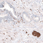 Beta III Tubulin Antibody in Immunohistochemistry (Paraffin) (IHC (P))