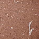 Beta III Tubulin Antibody in Immunohistochemistry (Paraffin) (IHC (P))