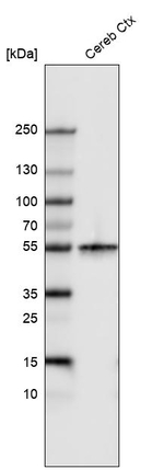 Beta III Tubulin Antibody in Western Blot (WB)