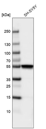 Beta III Tubulin Antibody in Western Blot (WB)