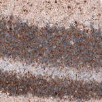 MAP2 Antibody in Immunohistochemistry (Paraffin) (IHC (P))