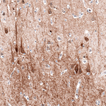 MAP2 Antibody in Immunohistochemistry (Paraffin) (IHC (P))