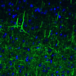 NEFL Antibody in Immunohistochemistry (Paraffin) (IHC (P))