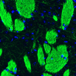 NEFL Antibody in Immunohistochemistry (Paraffin) (IHC (P))