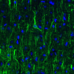 NEFL Antibody in Immunohistochemistry (Paraffin) (IHC (P))