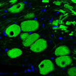NEFL Antibody in Immunohistochemistry (Paraffin) (IHC (P))
