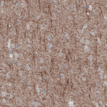 NEFL Antibody in Immunohistochemistry (Paraffin) (IHC (P))