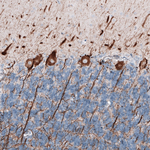 NEFL Antibody in Immunohistochemistry (Paraffin) (IHC (P))