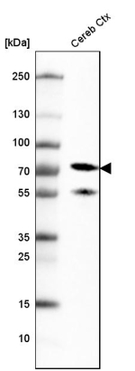 NEFL Antibody in Western Blot (WB)