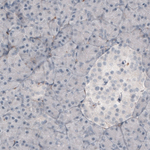 Fibronectin Antibody in Immunohistochemistry (Paraffin) (IHC (P))