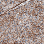 Fibronectin Antibody in Immunohistochemistry (Paraffin) (IHC (P))