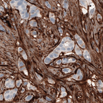 Fibronectin Antibody in Immunohistochemistry (Paraffin) (IHC (P))