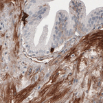 Fibronectin Antibody in Immunohistochemistry (Paraffin) (IHC (P))
