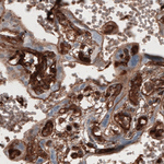 Fibronectin Antibody in Immunohistochemistry (Paraffin) (IHC (P))