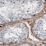 Fibronectin Monoclonal Antibody (CL3730)