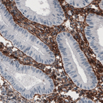 Fibronectin Antibody in Immunohistochemistry (Paraffin) (IHC (P))