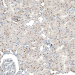 PAX8 Antibody in Immunohistochemistry (Paraffin) (IHC (P))