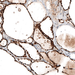 PAX8 Antibody in Immunohistochemistry (Paraffin) (IHC (P))