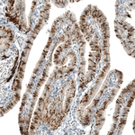 PAX8 Antibody in Immunohistochemistry (Paraffin) (IHC (P))
