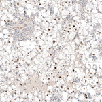 PAX8 Antibody in Immunohistochemistry (Paraffin) (IHC (P))