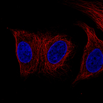 Desmin Monoclonal Antibody (CL4502)