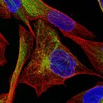 Desmin Antibody in Immunocytochemistry (ICC/IF)