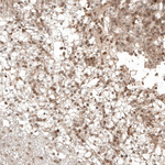 Bax Antibody in Immunohistochemistry (Paraffin) (IHC (P))