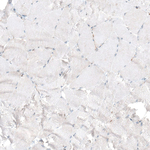 Bax Antibody in Immunohistochemistry (Paraffin) (IHC (P))