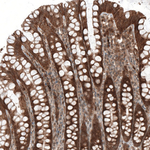 Bax Antibody in Immunohistochemistry (Paraffin) (IHC (P))