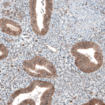 Bax Antibody in Immunohistochemistry (Paraffin) (IHC (P))