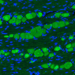 PGP9.5 Antibody in Immunohistochemistry (Paraffin) (IHC (P))
