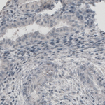 PGP9.5 Antibody in Immunohistochemistry (Paraffin) (IHC (P))