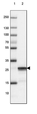 PGP9.5 Antibody in Western Blot (WB)