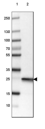 PGP9.5 Antibody in Western Blot (WB)
