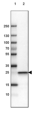 PGP9.5 Antibody in Western Blot (WB)