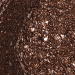 beta Actin Antibody in Immunohistochemistry (Paraffin) (IHC (P))